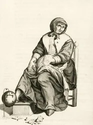 Verwendung eines mechanischen Blutegels, aus Exercitationes Practicae circa Medendi Methodum von Frederik Dekkers, 1694