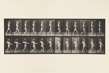 Tafel 540. A, O-Beine; Junge; B, Wirbelsäulenverkrümmung; Mädchen geht, 1885