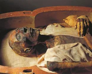 Mumie von Ramses II. (um 1297-1213 v. Chr.), Detail