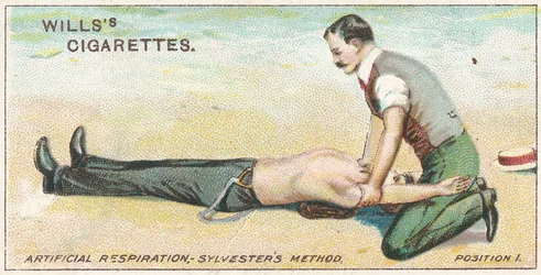 Künstliche Beatmung, Sylvesters Methode - Position 1, Nr. 17 aus der Erste-Hilfe-Serie von Willss Zigarettenkarten, 1913