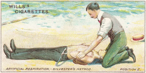 Künstliche Beatmung, Sylvesters Methode - Position 2, Nr. 17 aus der Erste-Hilfe-Serie von Willss Zigarettenkarten, 1913