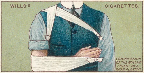 Kompression der Achselarterie durch ein Polster und Beugung, Nr. 41 aus der Erste-Hilfe-Serie von Willss Zigarettenkarten, 1913