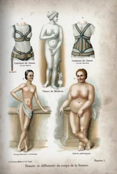 Schönheit und Deformität des Frauenkörpers: eine zu dünne und eine fettleibige Frau unter der Venus von Medici, als „ideale Frau“ betrachtet