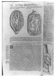 Fötus, Illustration aus Oeuvres von Ambroise Paré (1509-90), veröffentlicht in Lyon, 1641