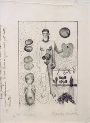 Frida und die Fehlgeburt