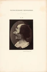 Électro-Physiologie Photographique, Abbildung 39