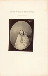 Électro-Physiologie Photographique, Abbildung 76