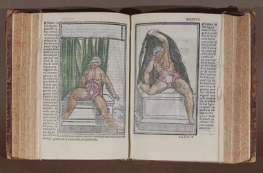 Weibliche Anatomie, aus Commentaria cum amplissimis additionibus super anatomiam mundini, von Jacopo Berengario da Carpi (ca. 1460-ca. 1530) veröffentlicht in Bologna, 1521 (Farbholzschnitt)
