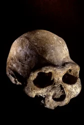 Homo erectus Schädel, zahnlos, Dmanisi, Georgien Homo Erectus Fundstätte