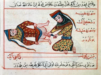 Medizin: Operation an einem Hermaphroditen. Miniatur aus einer Abhandlung über türkische Medizin von Sharaf al-Din